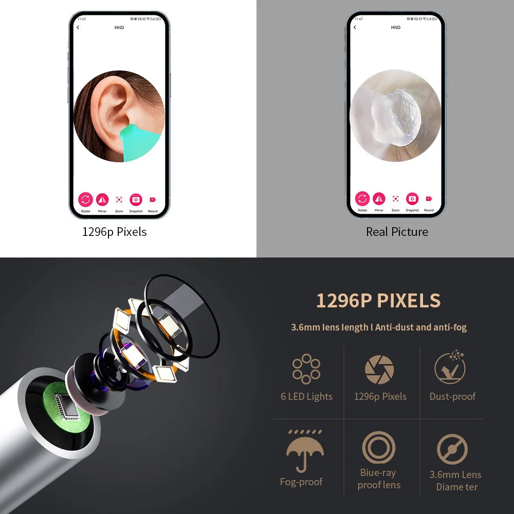 Smart Visual Ear Cleaner with Camera | USB-C Ear Wax Removal Tool