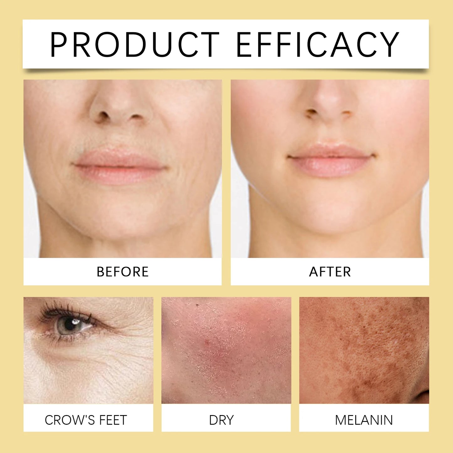 Bee Venom Cream for Anti-Aging | Firming & Nourishing Moisturizer