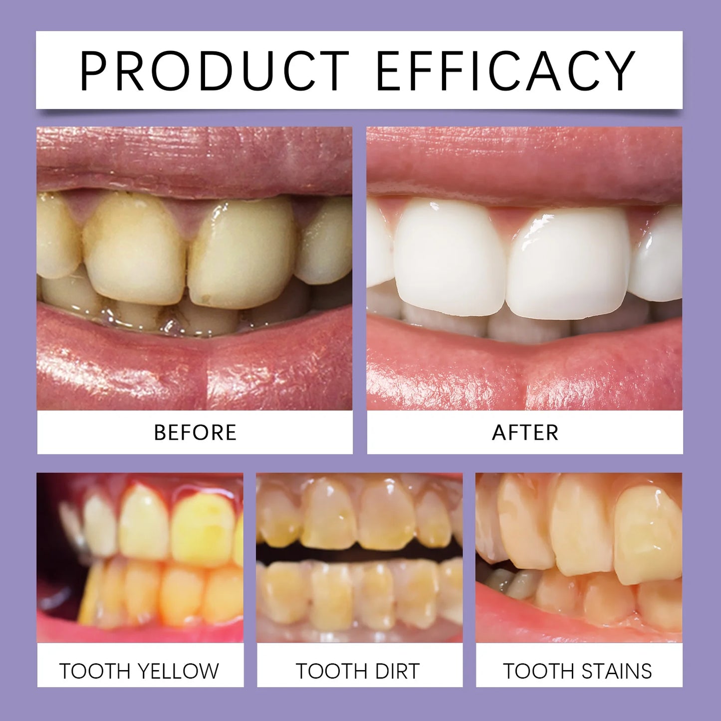 Purple Glossy Tooth Strips Gentle Care for Shiny Teeth, Cleans Stains, Easy-to-Use Tooth Strips