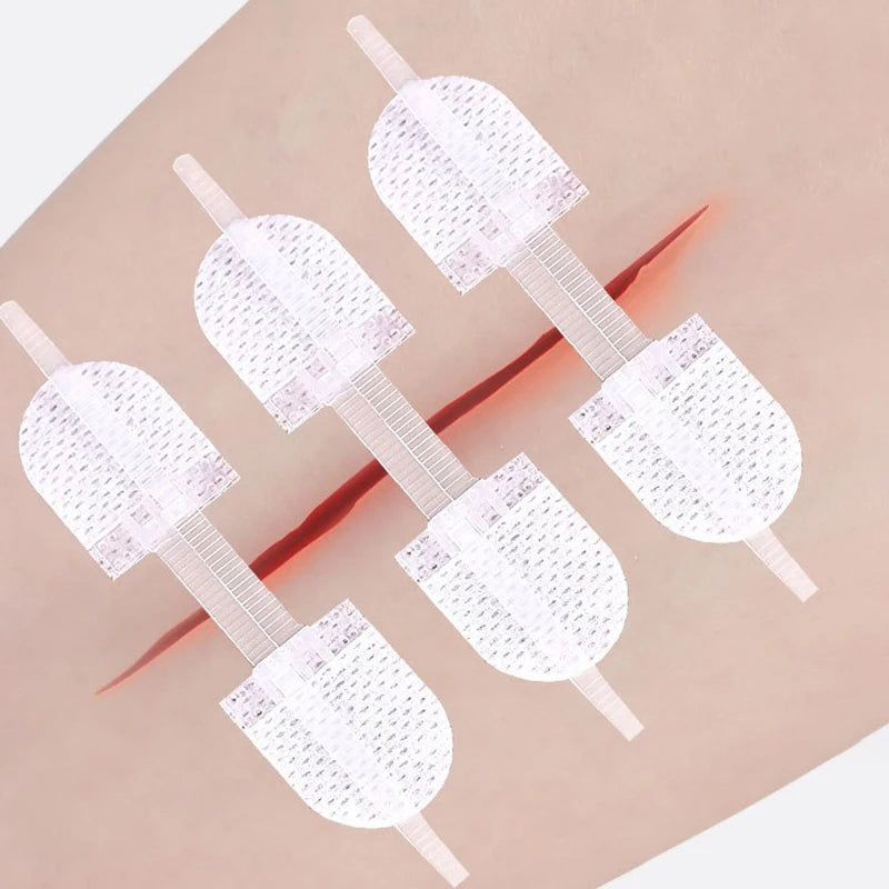 Breathable Wound Care Closure Patches | Seamless Elastic Bandages