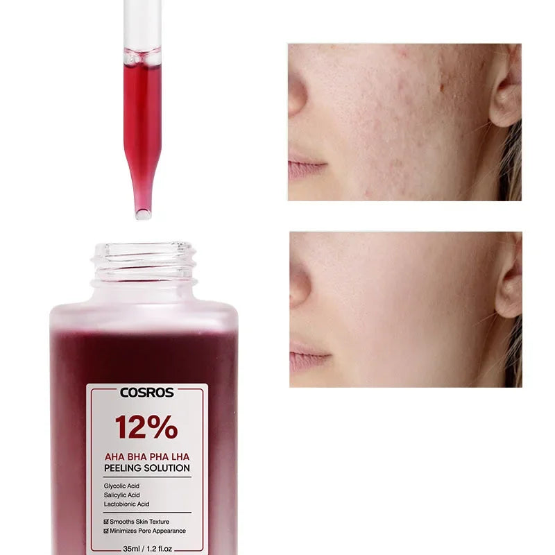 Exfoliating Salicylic Acid Essence | Pore Minimizing Serum