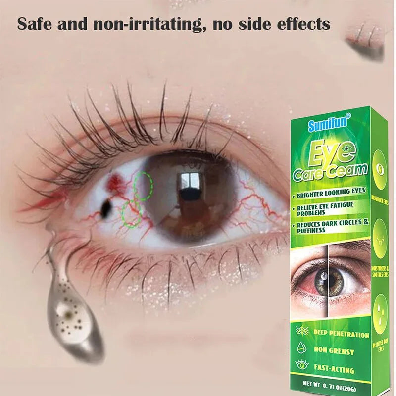 Herbal Eye Care Cream for Dark Circles & Puffiness Relief