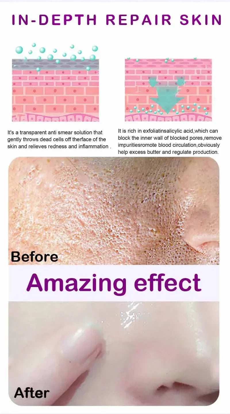 Pore Refining Resurfacing Serum | Brightening Facial Elixir