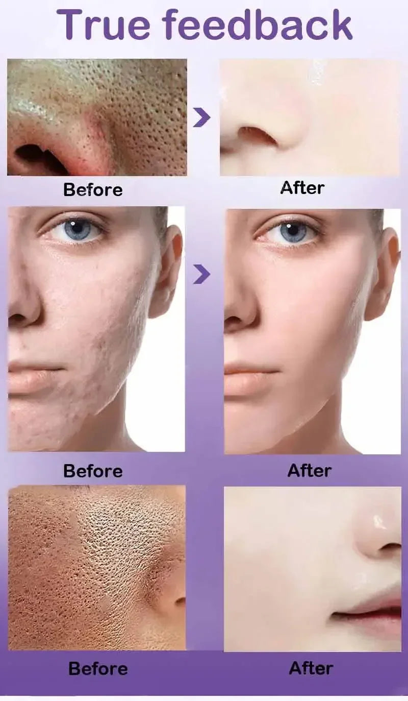 Pore Refining Resurfacing Serum | Brightening Facial Elixir