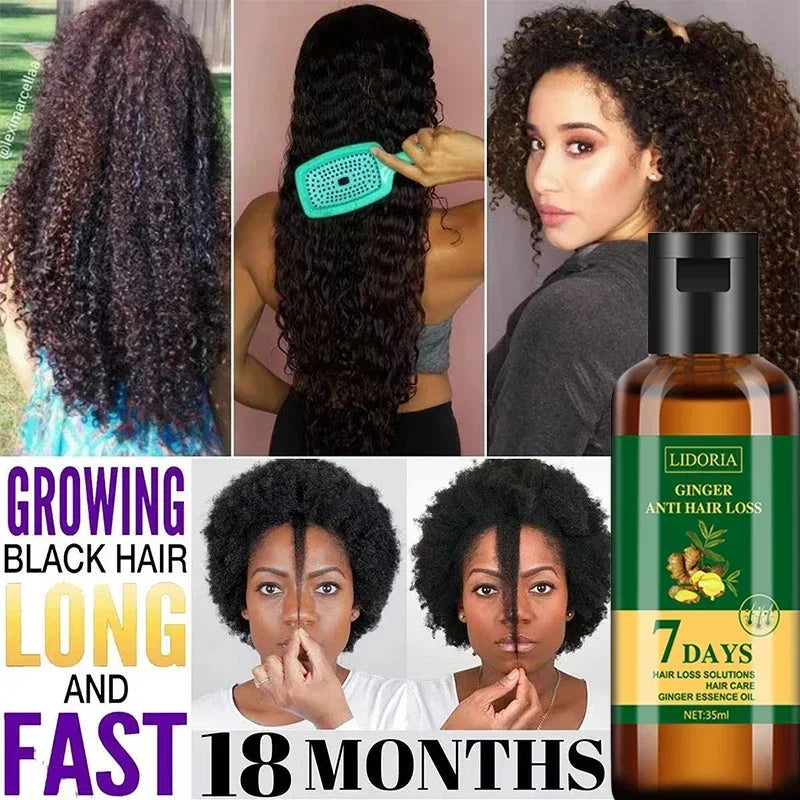 Ginger Hair Growth Essential Oil | Anti-loss Regrowth Serum
