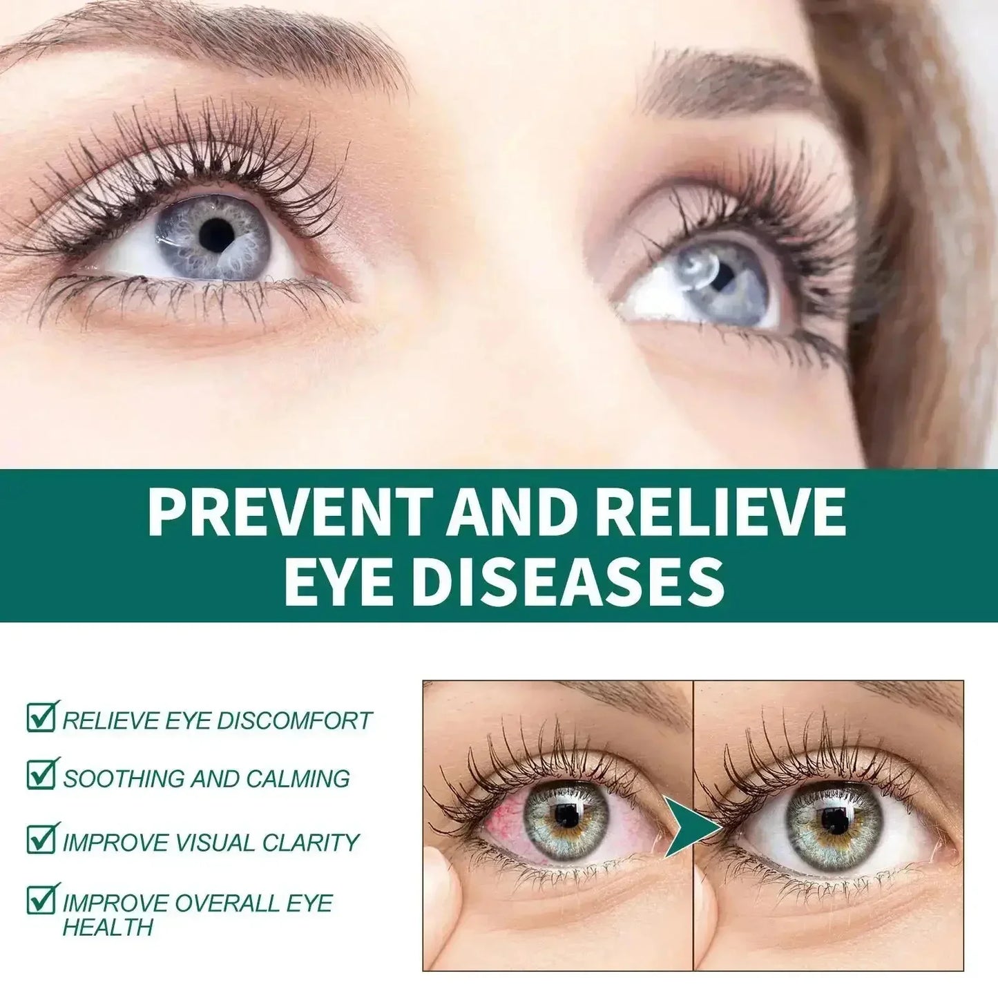 Vision Enhancer Roller | Improve Eyesight & Relieve Fatigue
