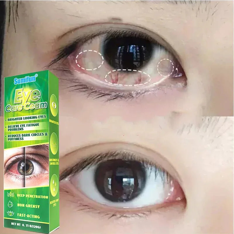Herbal Eye Care Cream for Dark Circles & Puffiness Relief