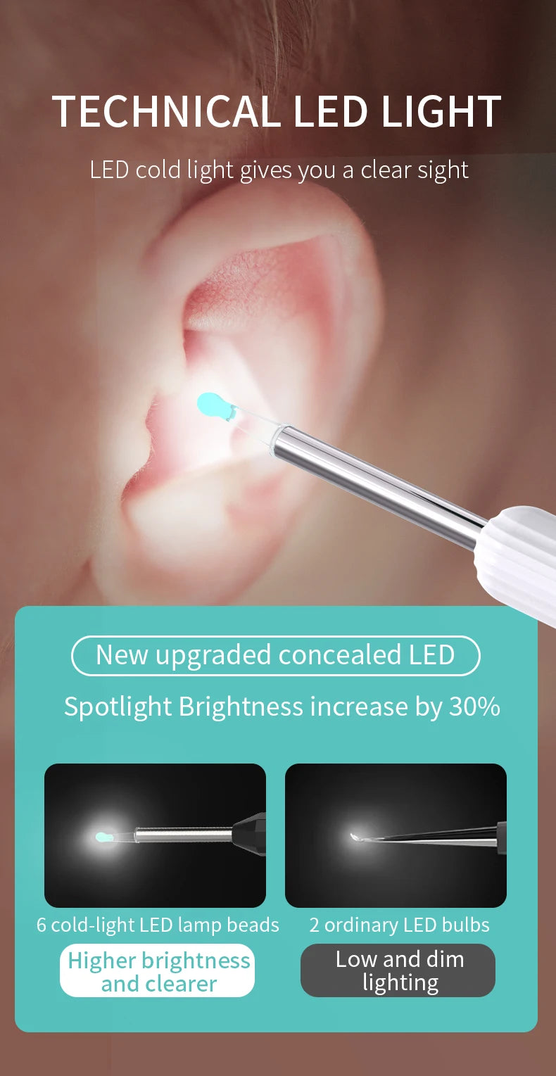 Smart Visual Ear Cleaner with Camera | USB-C Ear Wax Removal Tool