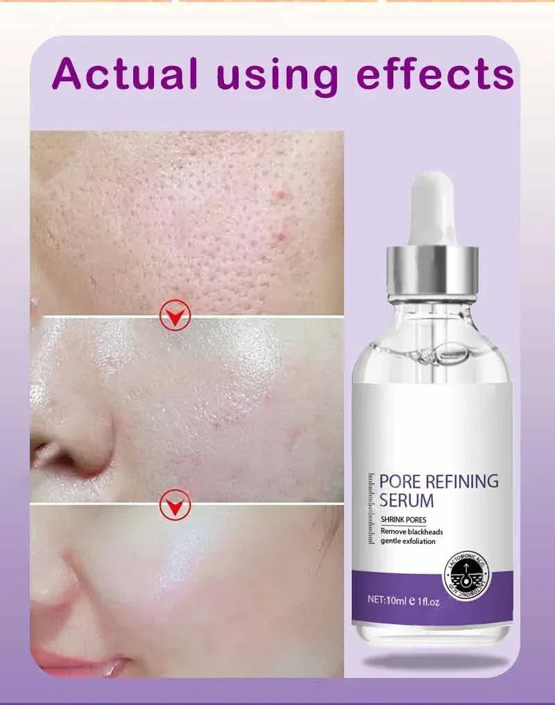 Pore Refining Resurfacing Serum | Brightening Facial Elixir
