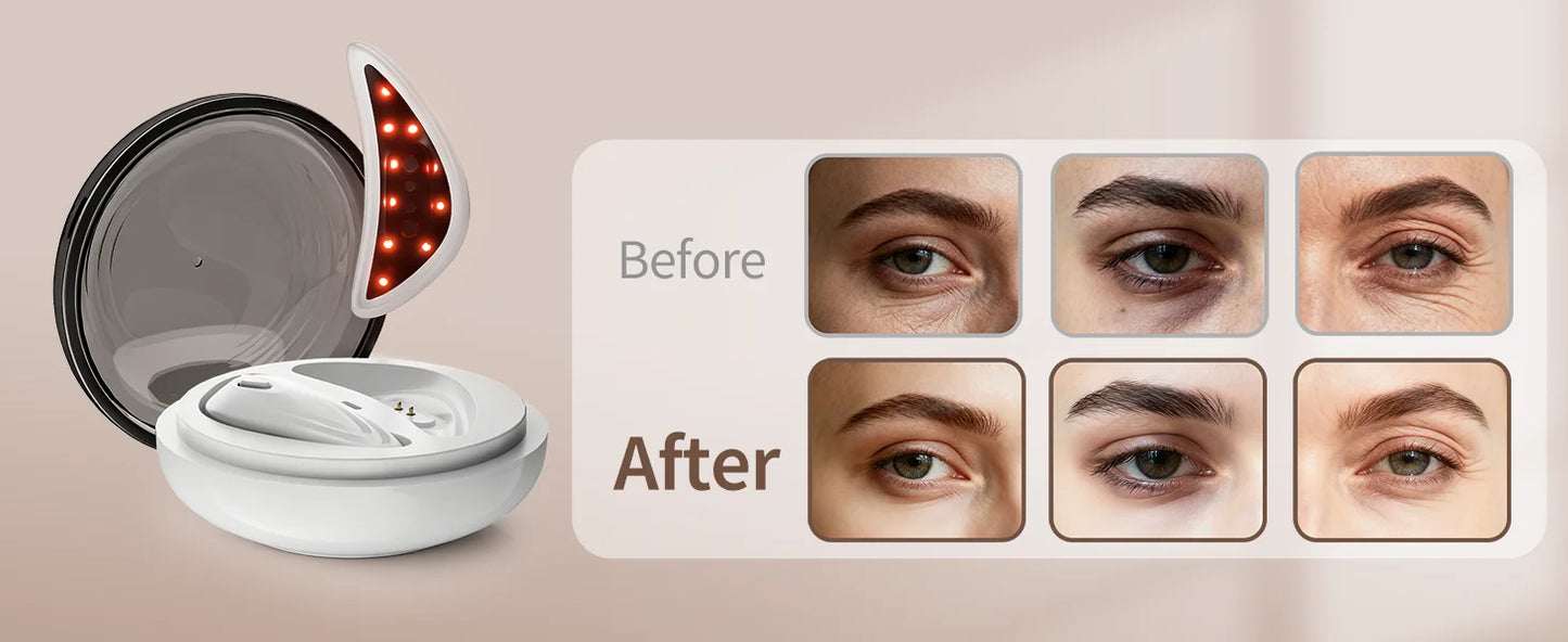 Eye Massage & Cooling Pad Set | Reduce Puffiness & Dark Circles