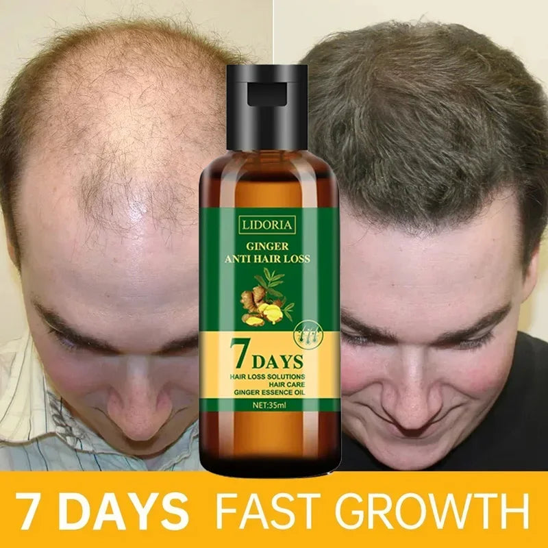 Ginger Hair Growth Essential Oil | Anti-loss Regrowth Serum