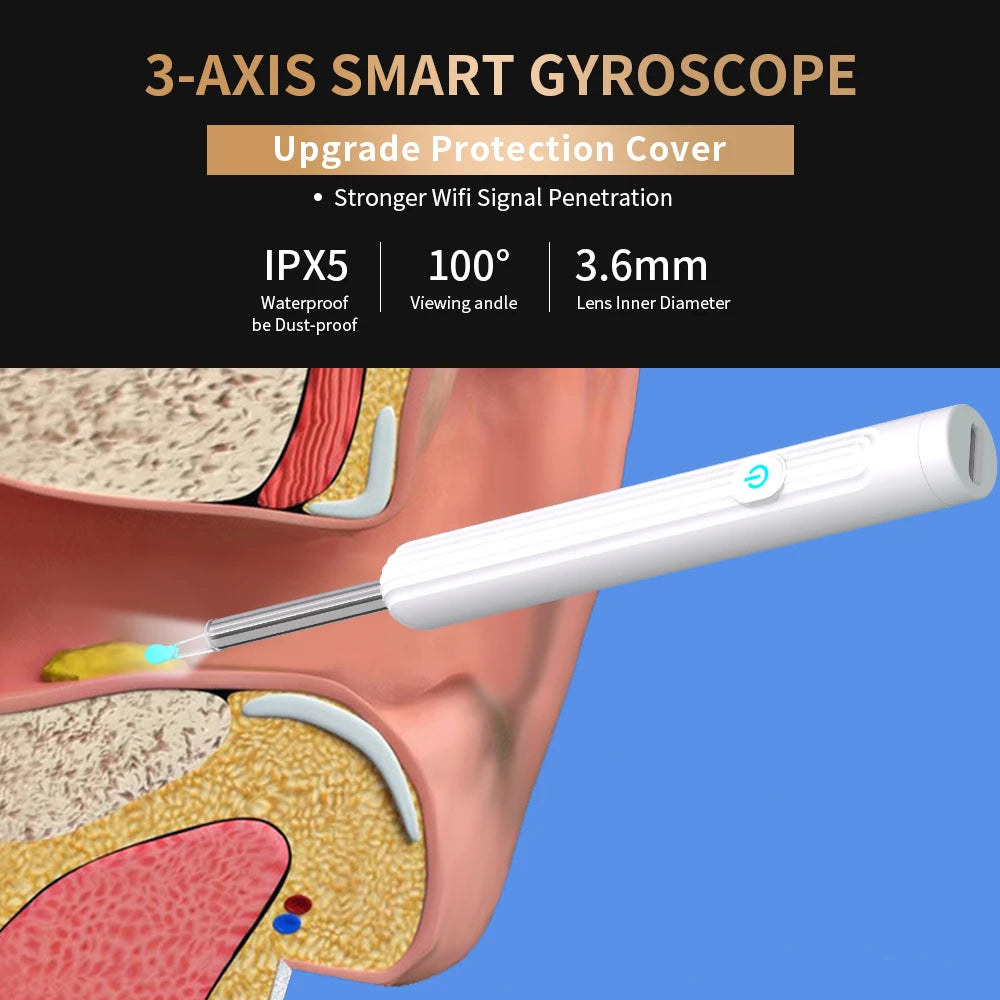 Smart Visual Ear Cleaner with Camera | USB-C Ear Wax Removal Tool