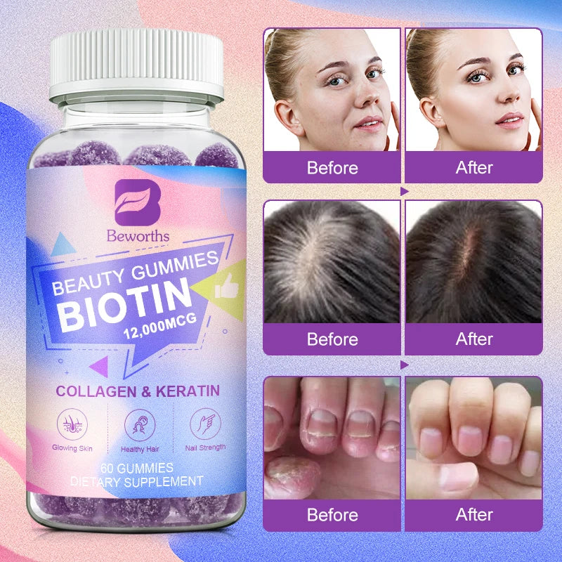 Vitamin Biotin Gummies for Stronger Hair, Skin & Nails - 60 Gummies