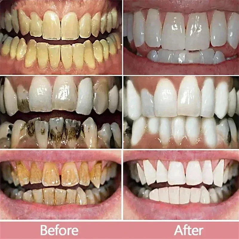 Bestselling Whitening Toothpaste | Brighten Your Smile Naturally