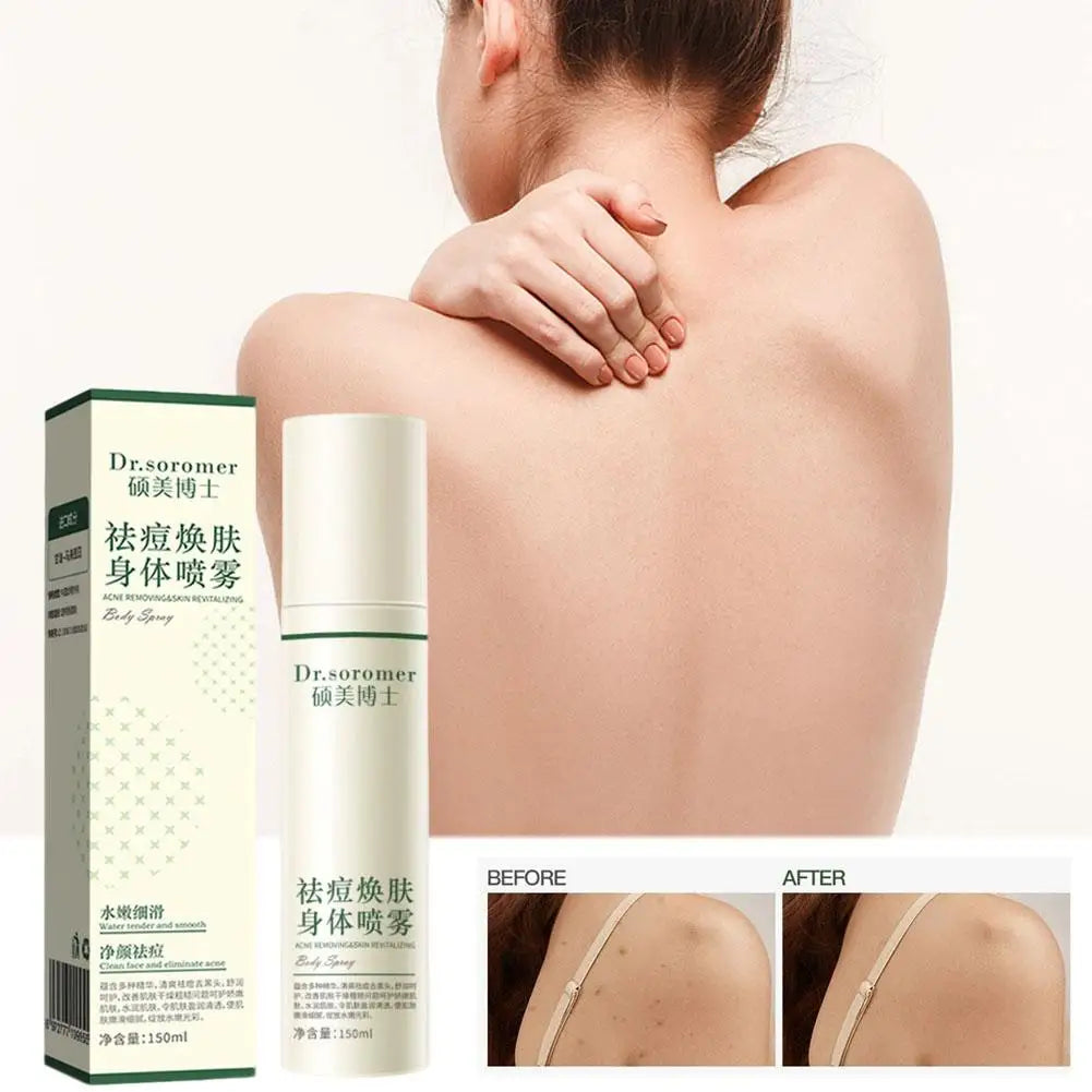 Revitalizing Body Spray for Clear, Smooth Skin | Acne & Oil Control