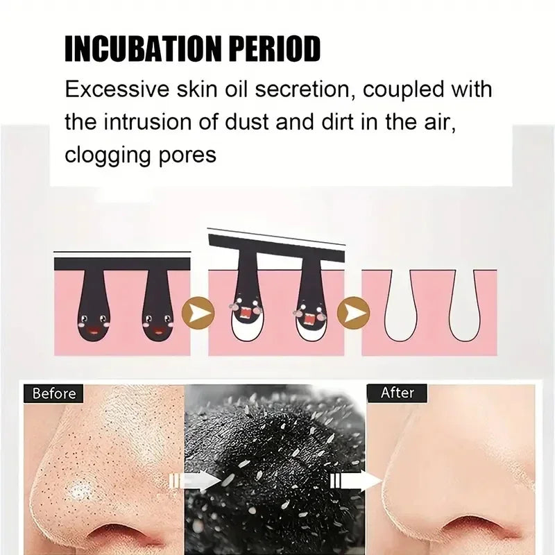 50/100PCS Charcoal Nose Strips for Blackhead Removal & Acne Treatment