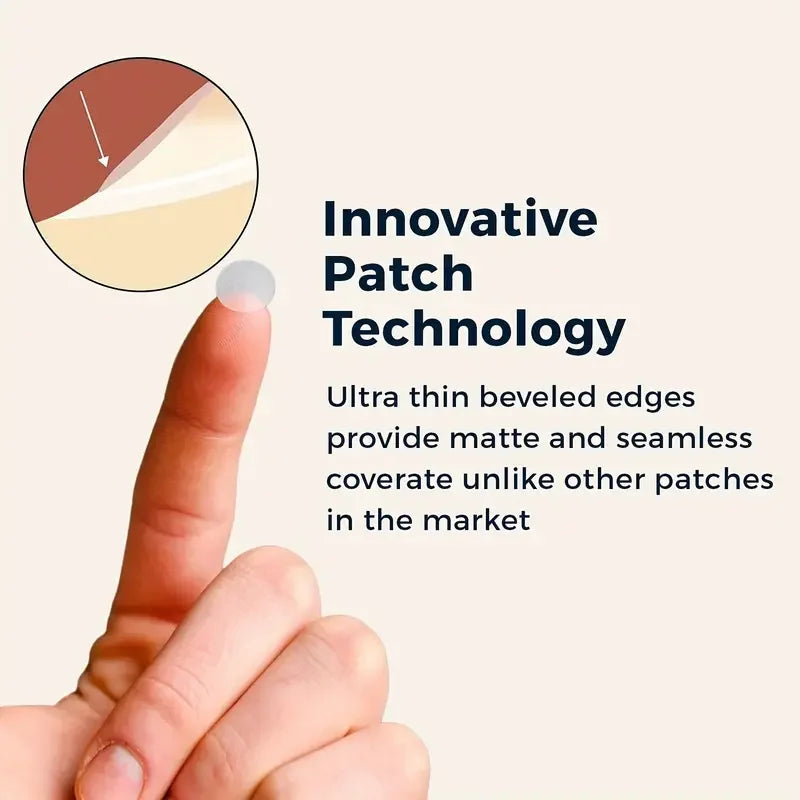 Invisible Clear Pimple Patch Set – Hydrocolloid Acne Stickers