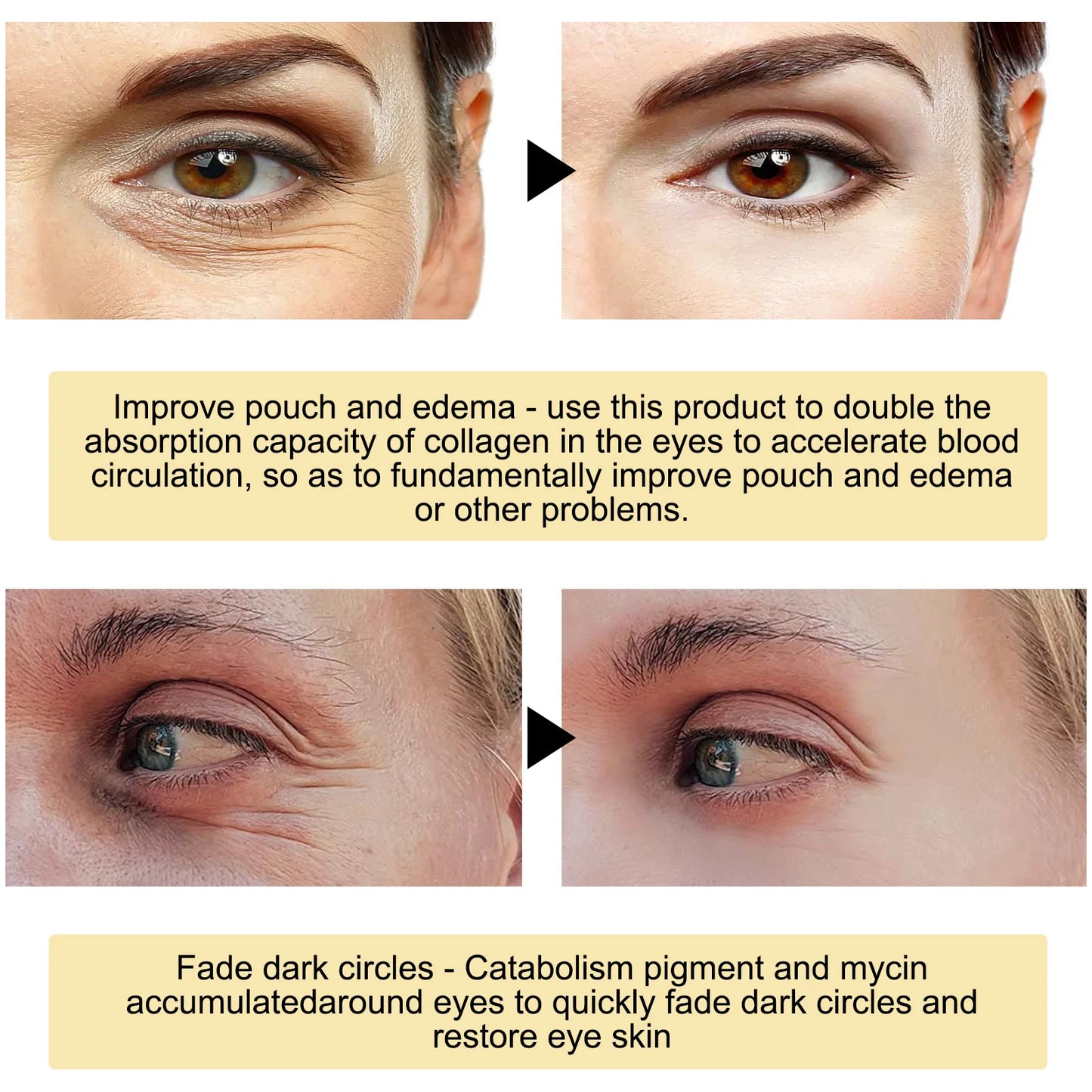 24k Gold Under Eye Patches | Anti-Aging Eye Mask for Dark Circles