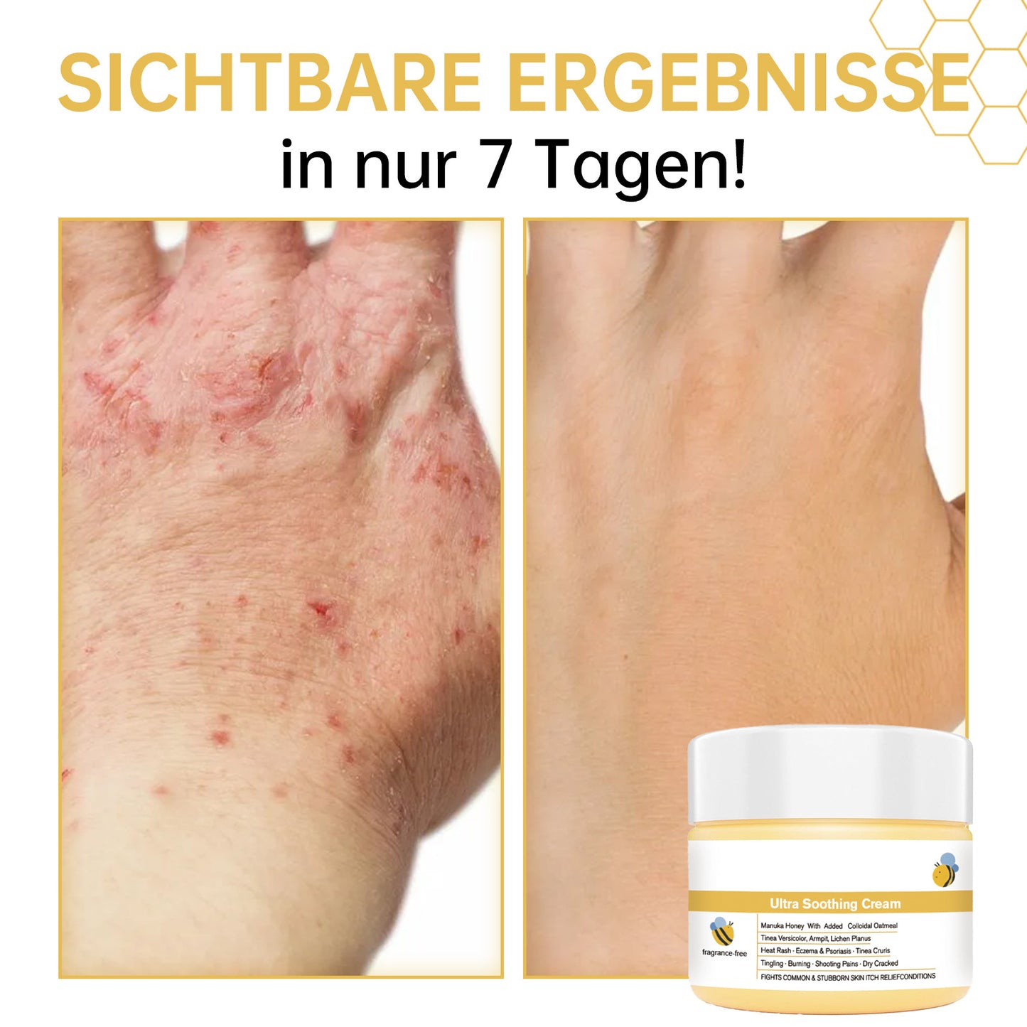 Soothing Anti-Itch Honey Cream | Natural Skin Relief