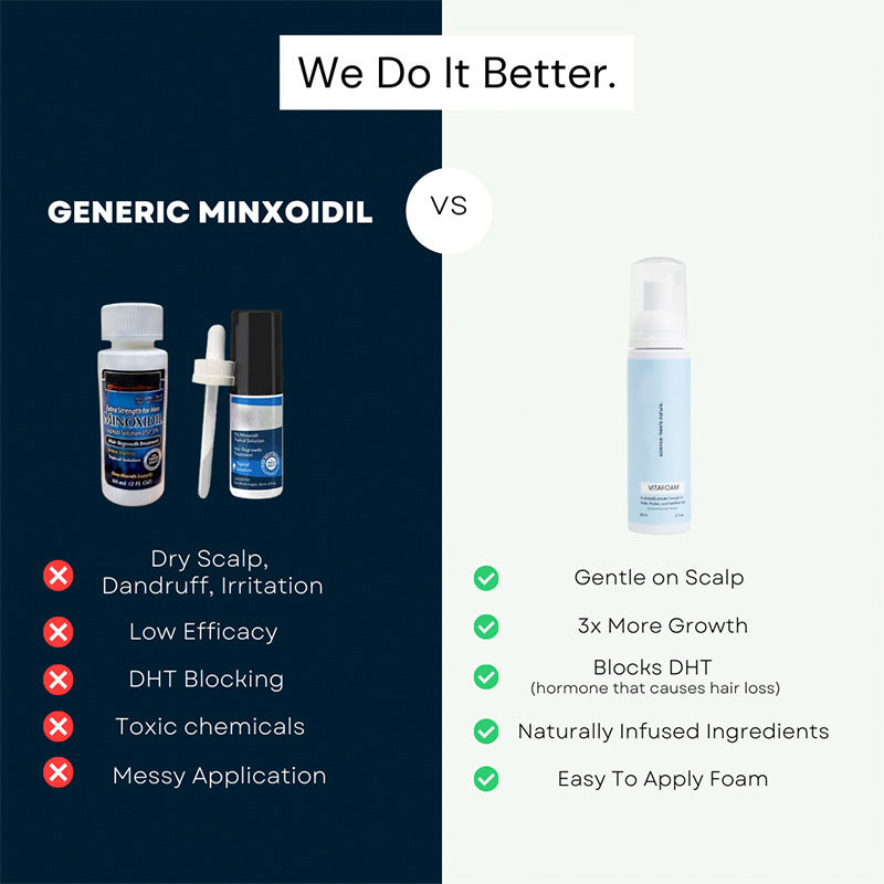 Minoxidil Hair Regeneration Foam Serum | Effective Hair Growth Solution