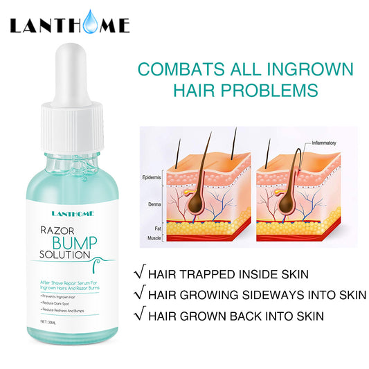 Hair Ingrowth Prevention Essence | Gentle, Effective Hair Care
