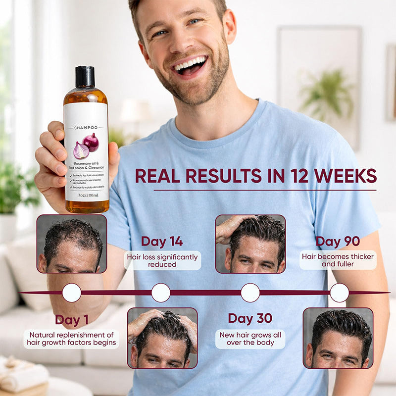 Volumizing Hair Shampoo with Red Onion Extract | Free Shipping